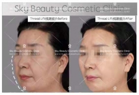 悉尼医疗美容服务脸部整形 sky beauty Cosmetic Clinic thumbnail version 0