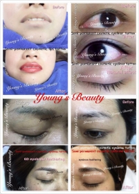 Young's Beauty thumbnail version 18